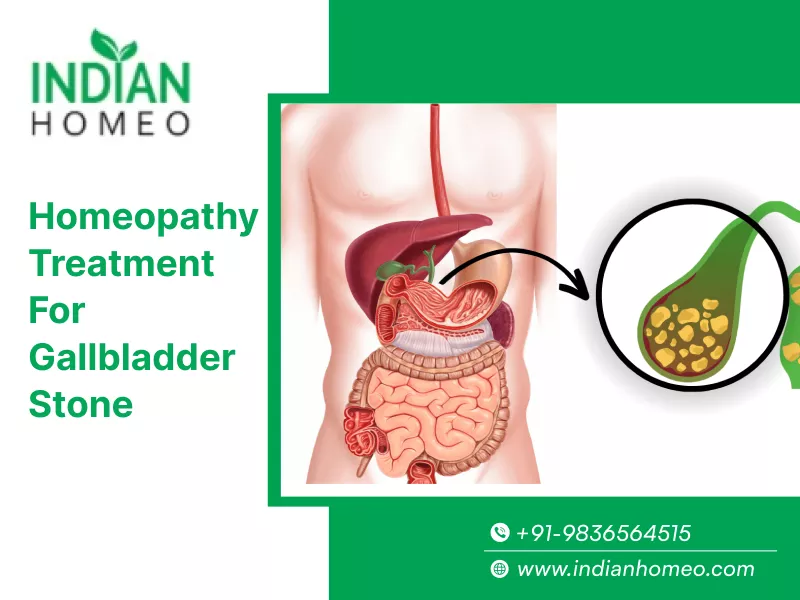 Gallbladder Stone