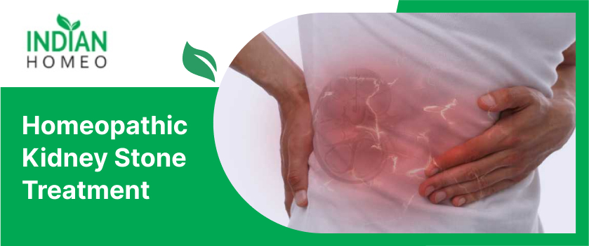 Picture of Effective Homeopathic Kidney Stone Treatment - Indian Homeo